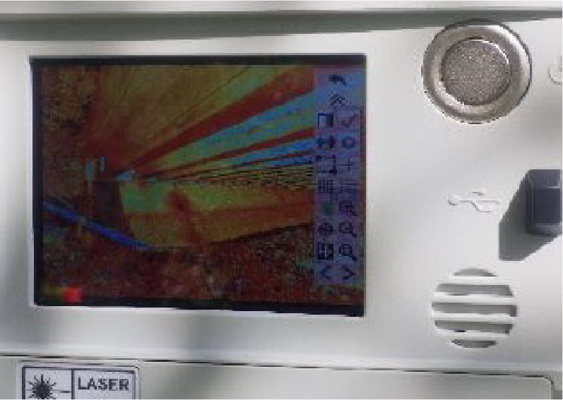 3Dレーザースキャナー